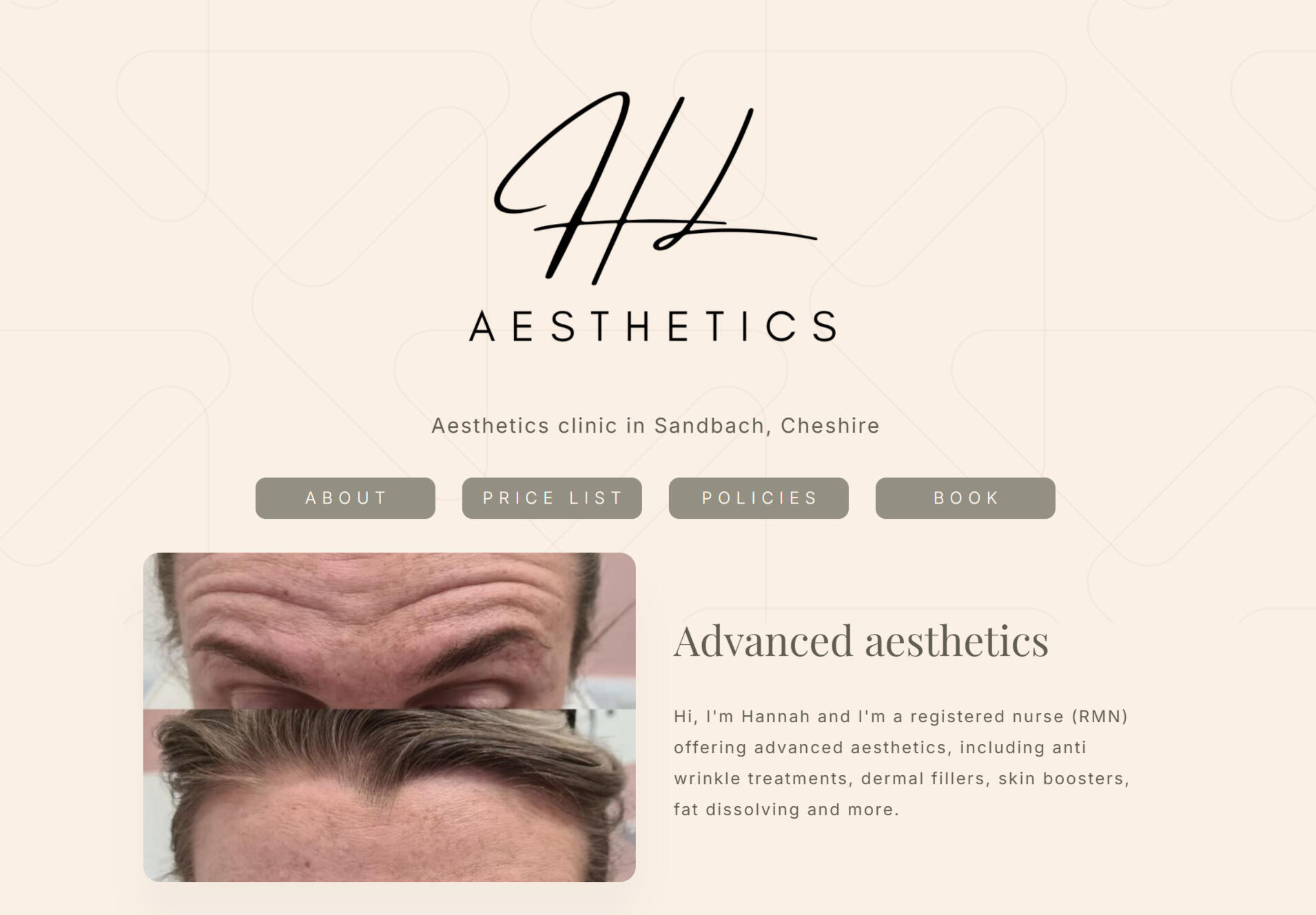 HL Aesthetics | Tier 1